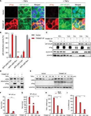 TRIM67 Suppresses TNFalpha-Triggered NF-kB Activation by Competitively Binding Beta-TrCP to IkBa